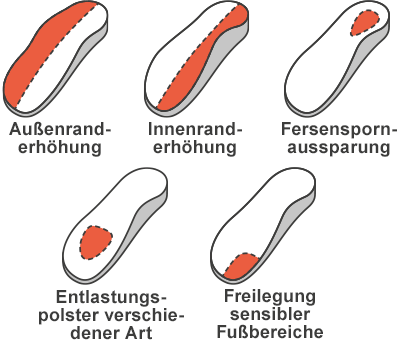 Mögliche Zurichtungen für Tofinos: Außenranderhöhung, Innenranderhöhung, Fersenspornaussparung, Entlastungspolster verschiedener Art, Freilegung sensibler Fußbereiche
